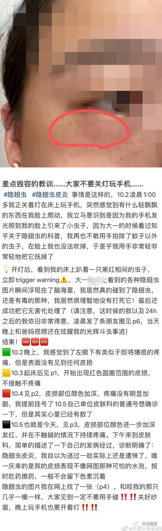 隐翅虫不简单，了解一下这种昆虫的特点和生态习性（隐翅虫的分类和习性特点）(图1)