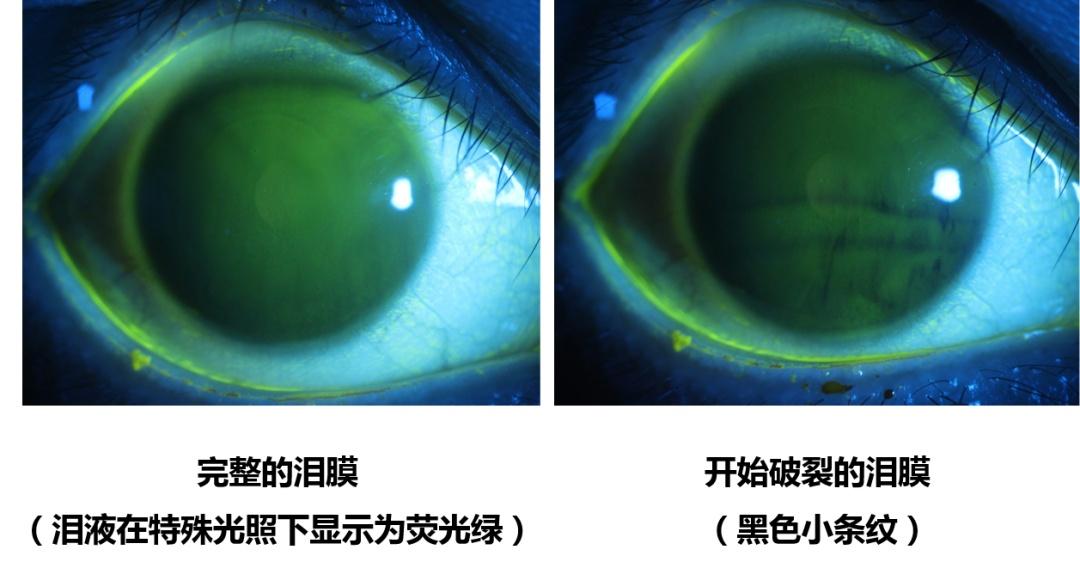 长时间使用手机的对眼睛的影响（探讨长期使用手机对眼睛健康的影响机制）(图2)